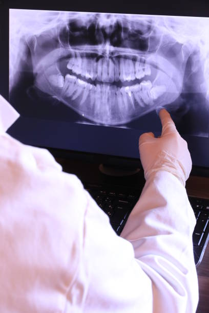Best Knocked-Out Tooth Emergency  in Hilton Head Island, SC